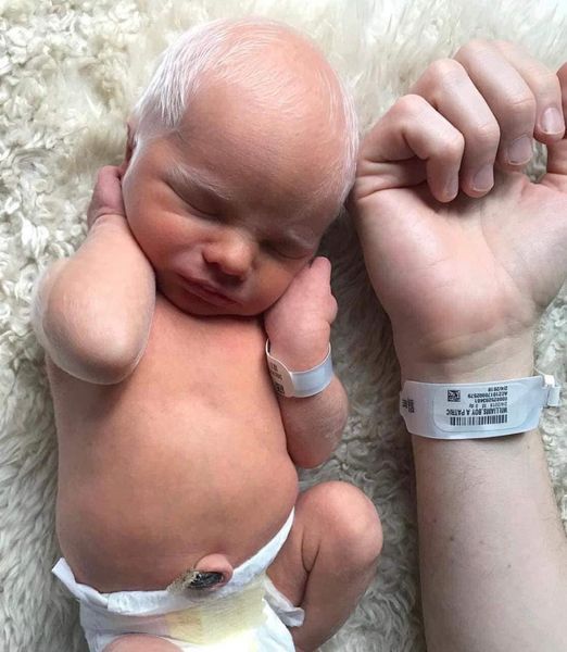 Baby mocked for having white hair – years later, he looks perfectly happy and healthy