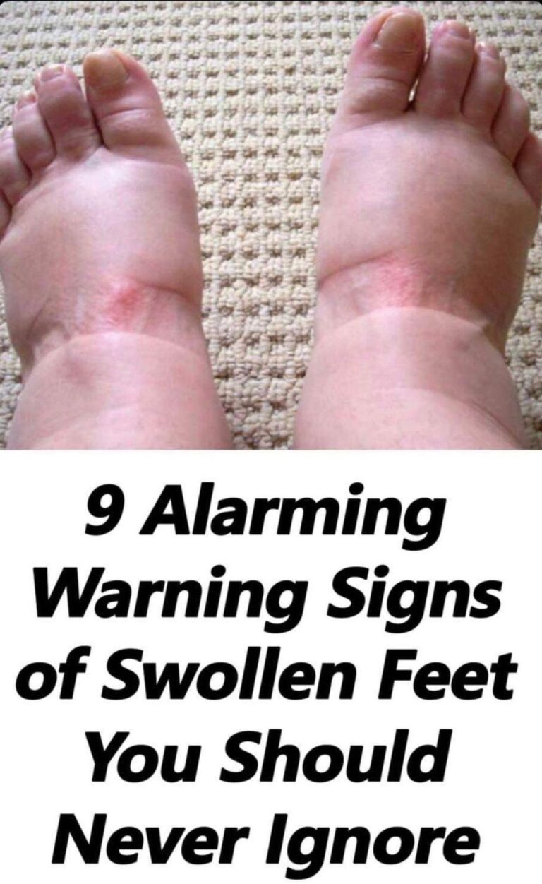 There are nine scary warning symptoms of swollen feet that you should never overlook