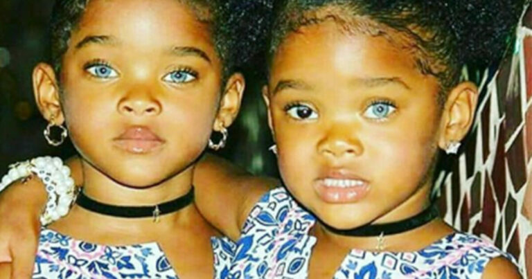 Meet the “Trueblue Twins” who are now gaining a massive Instagram following