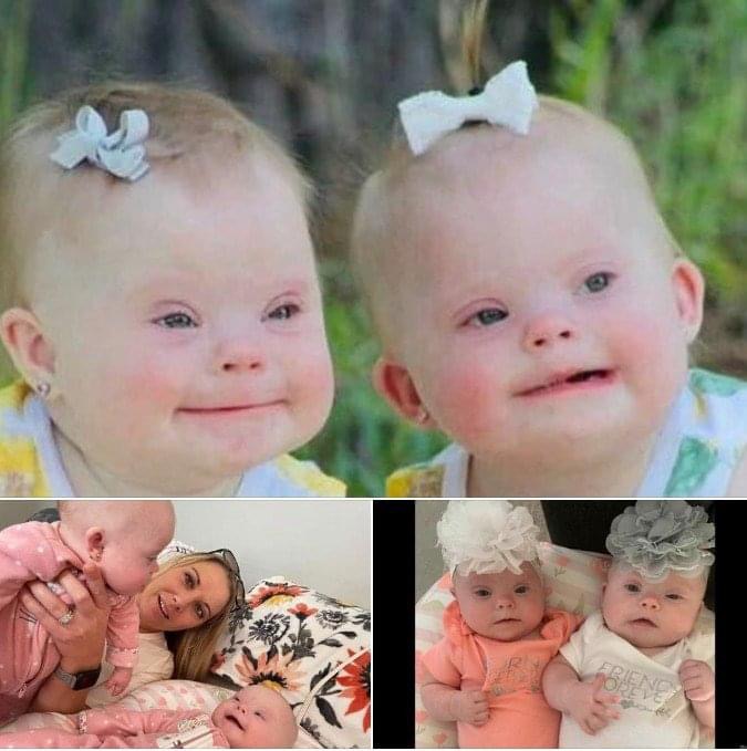 Mom of rare twins with Down syndrome show just how beautiful and precious they are to shut down critics