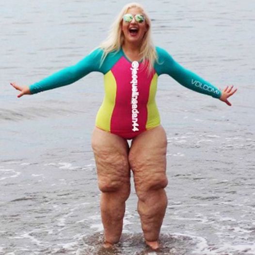 A woman who lost 350 pounds had the best response to being body shamed at the beach