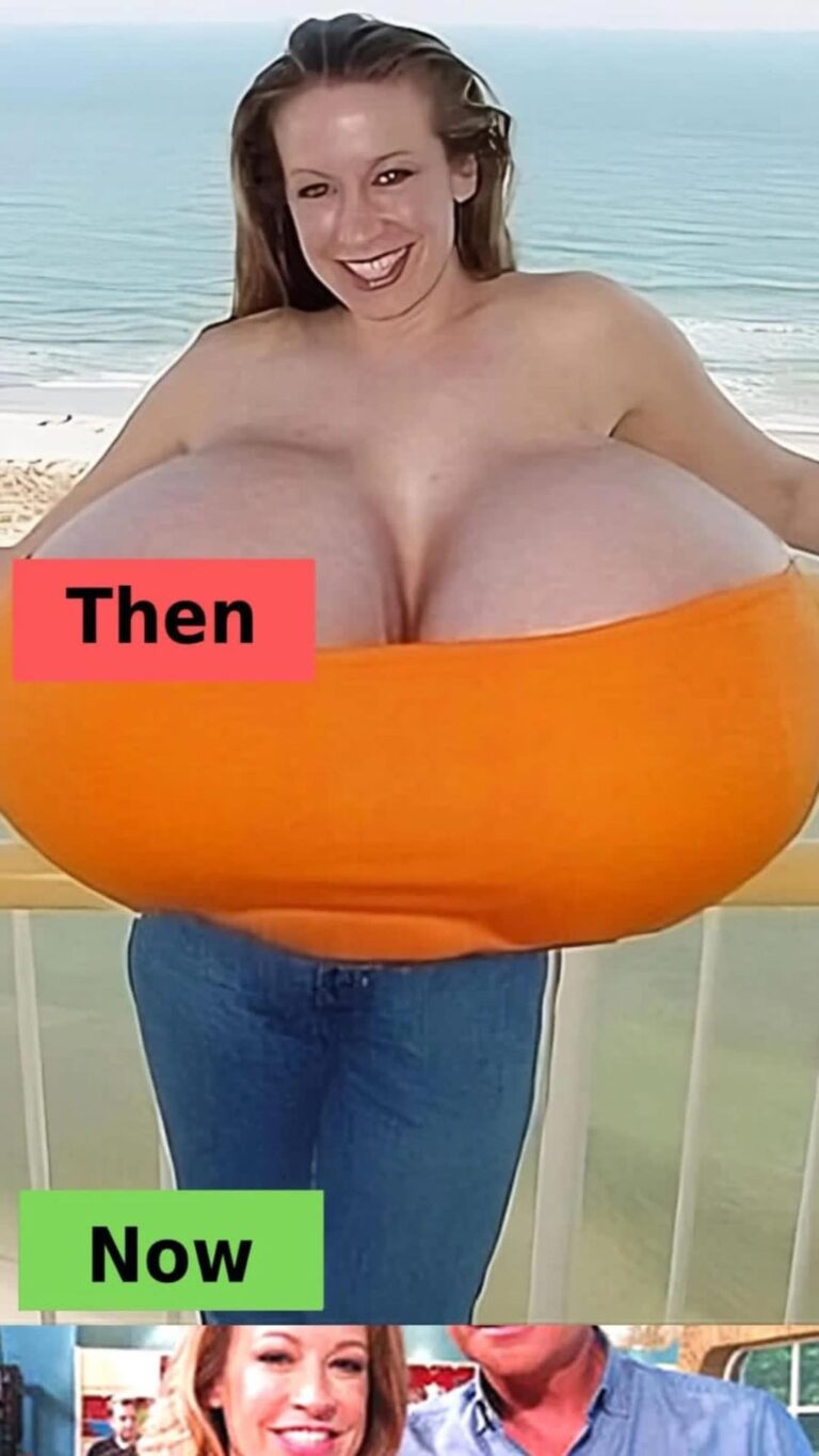 5 Women with Exceptionally Huge Boobs