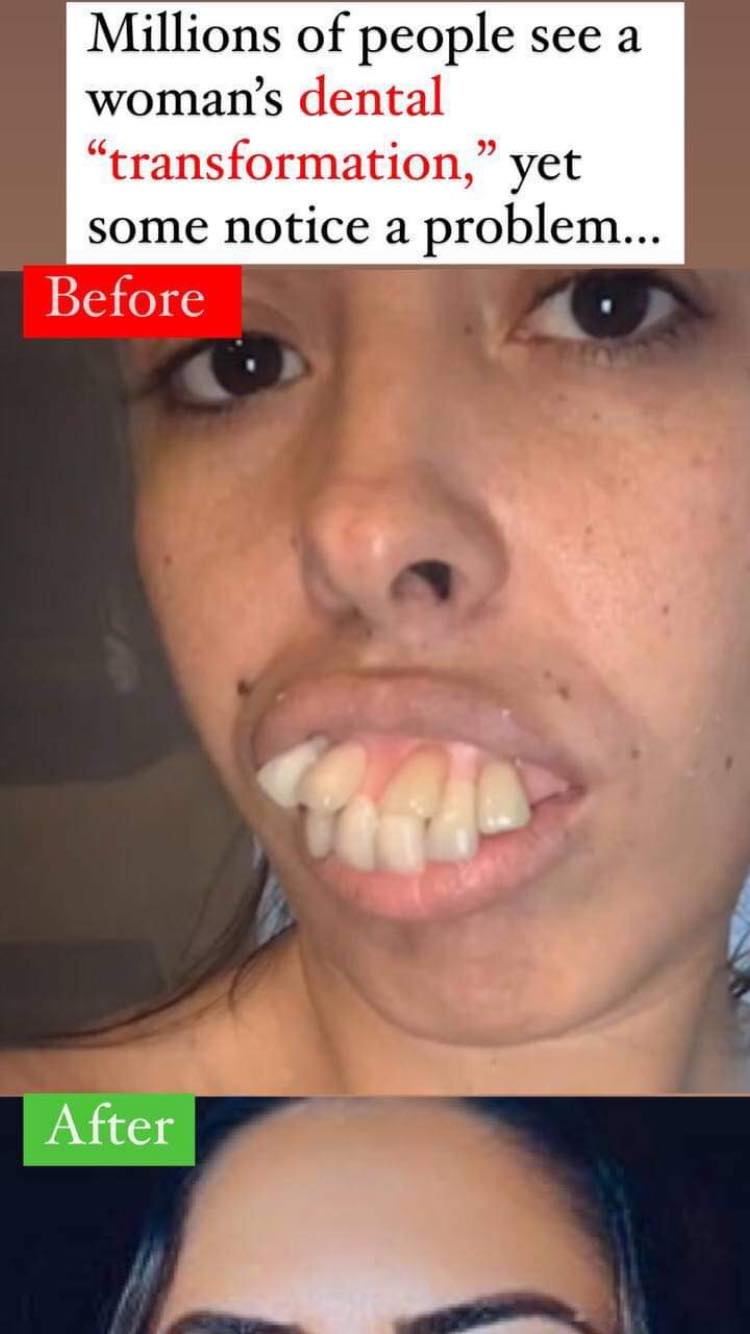 A woman’s “dental metamorphosis” is visible to millions of people, but some people spot a problem.