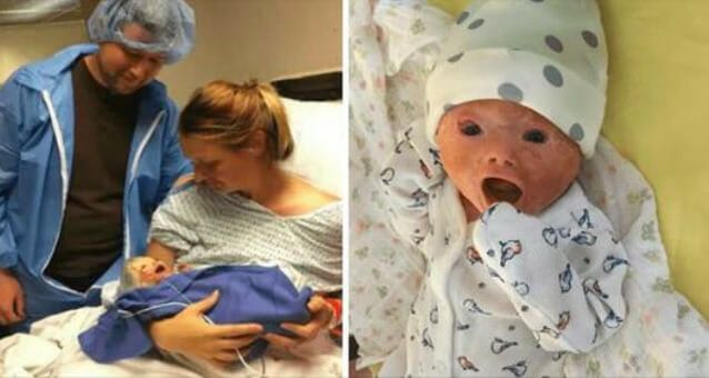 Doctors perform an emergency C-section and give birth to a baby with a rare skin disease.