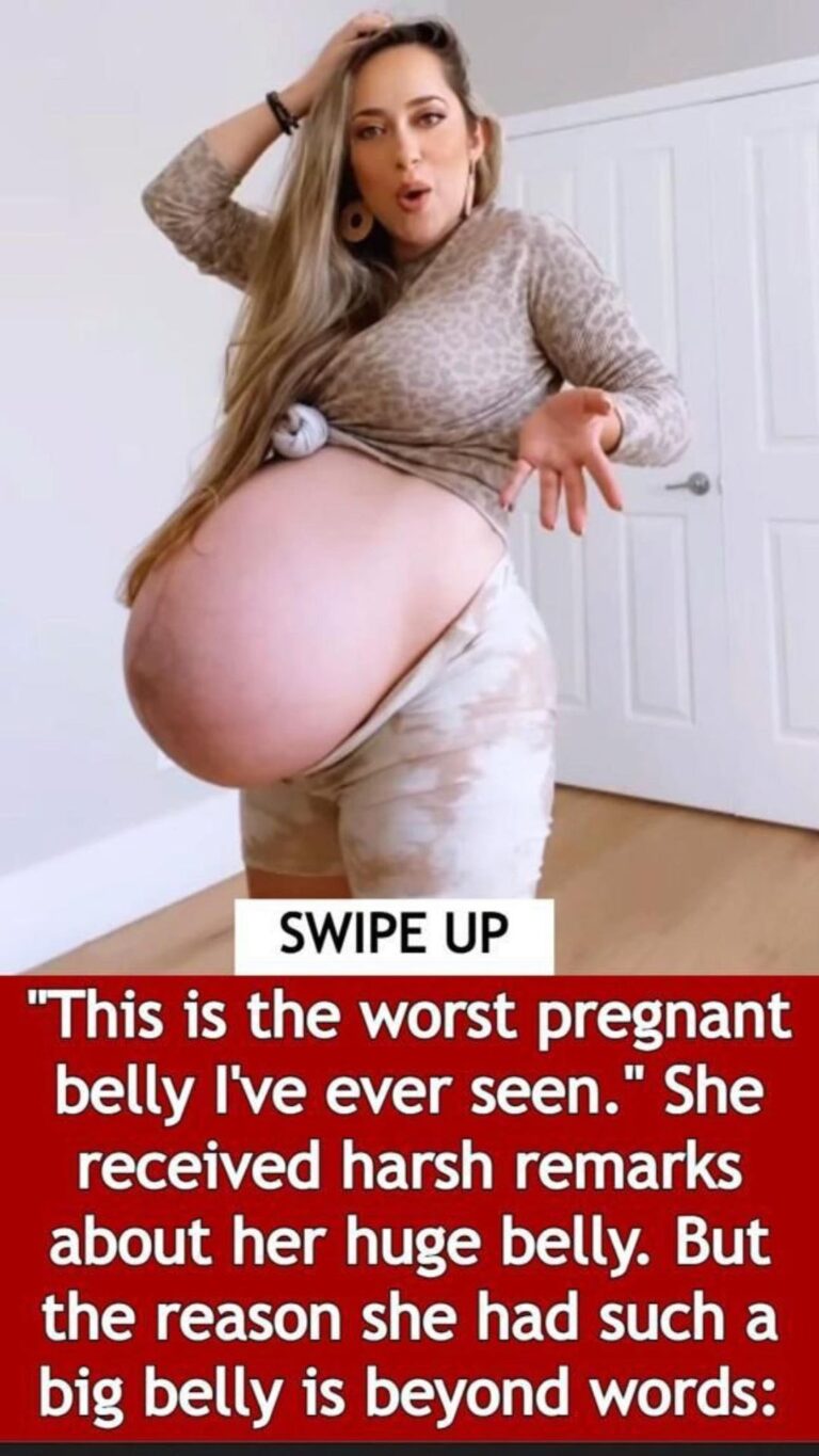 Harsh Remarks About Her Large Belly: “The Worst Pregnant Belly I Have Ever Seen”