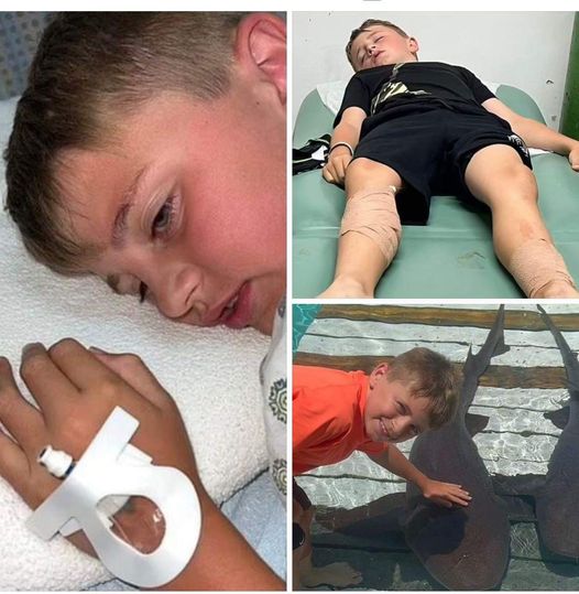 Tourists’ food attracts three sharks, leading to an attack on a young boy in the Bahamas