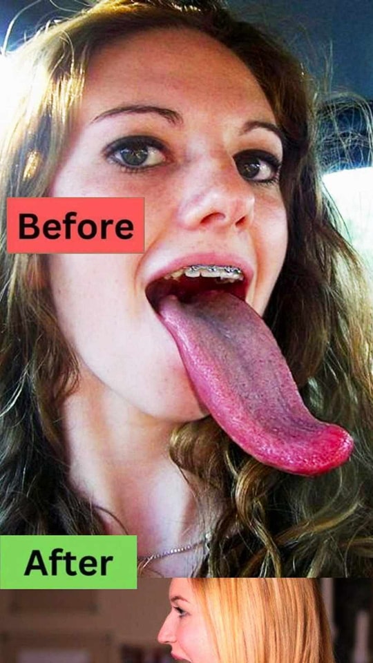 Fun Facts About The Tongue