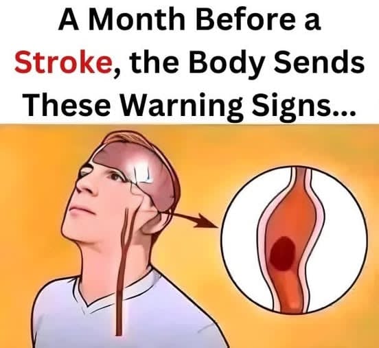 Attention… A Month Before a Stroke, Your Body Sends These Signals…