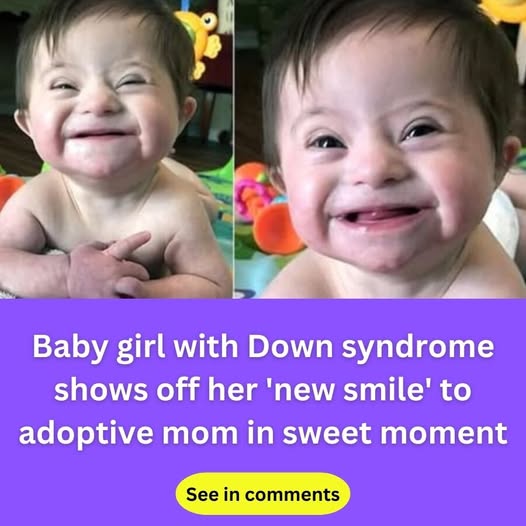 Adopted baby with Down syndrome goes viral after smiling for mom