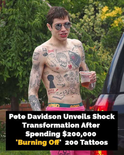 Pete Davidson’s new look after “burning off” almost 200 tattoos