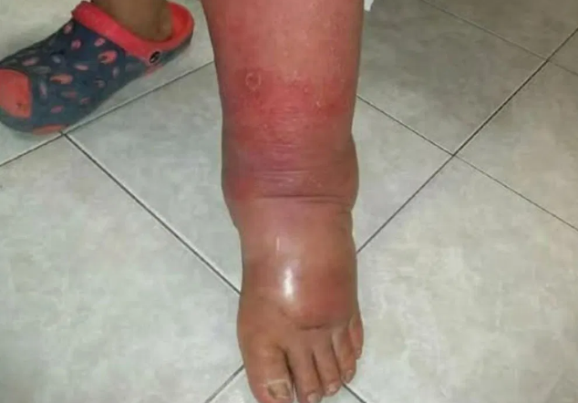 Your Feet: Hidden Windows to Your Overall Health